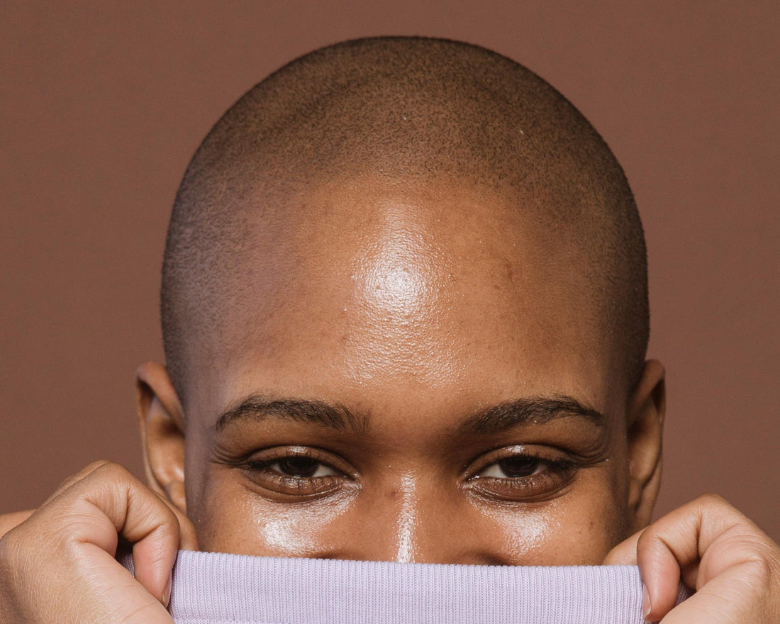 Understanding Alopecia: A Factual Guide for Awareness Month