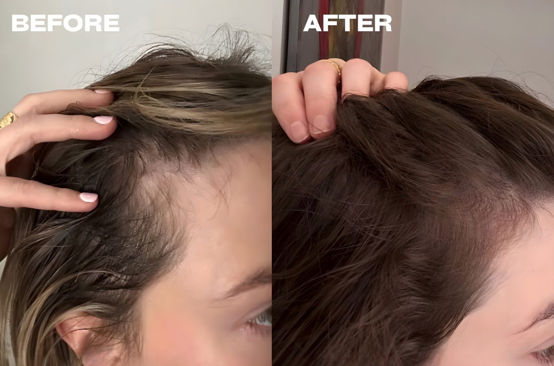 Before and after comparison of hair texture and volume.